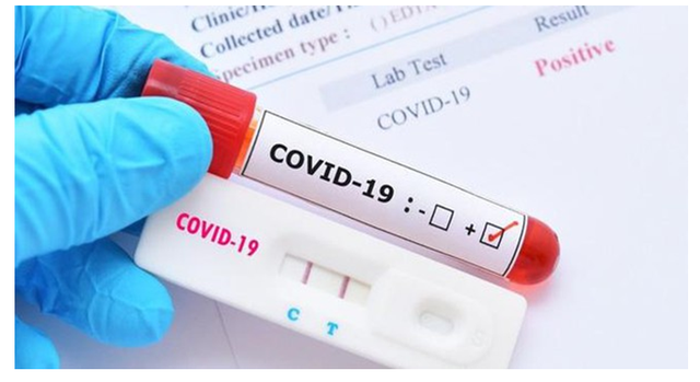 Xét nghiệm COVID-19 bằng phương pháp test nhanh kháng nguyên (mẫu đơn)