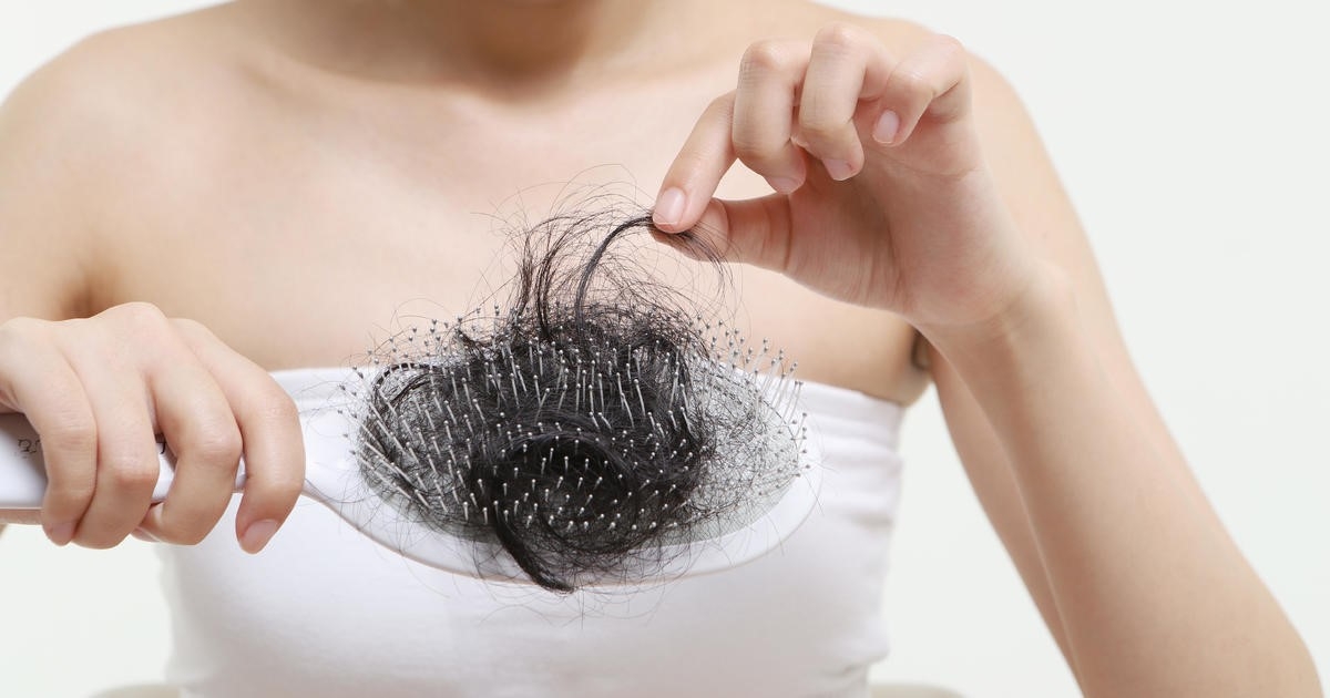 Bỏ túi 5 cách trị rụng tóc đơn giản được các chuyên gia khuyên dùng – Công  Ty Cổ Phần Sao Thái Dương
