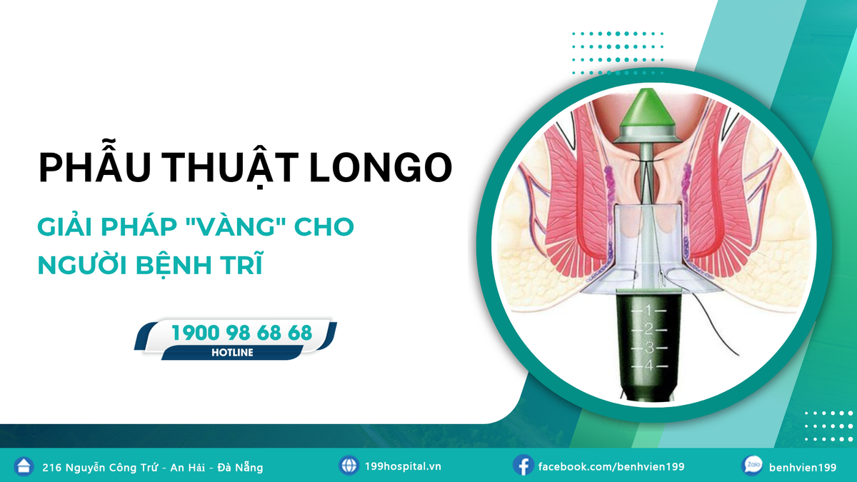 Phẫu thuật Longo - Giải pháp "Vàng" cho người bệnh Trĩ