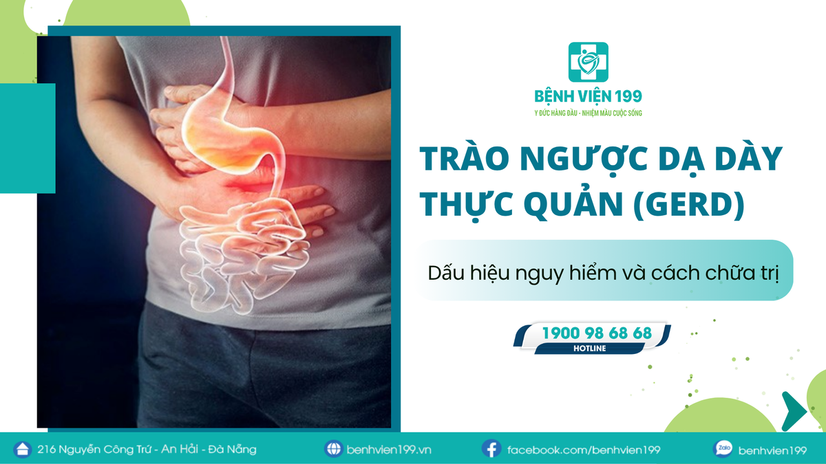 Trào ngược dạ dày thực quản (GERD): Dấu hiệu nguy hiểm và cách chữa trị