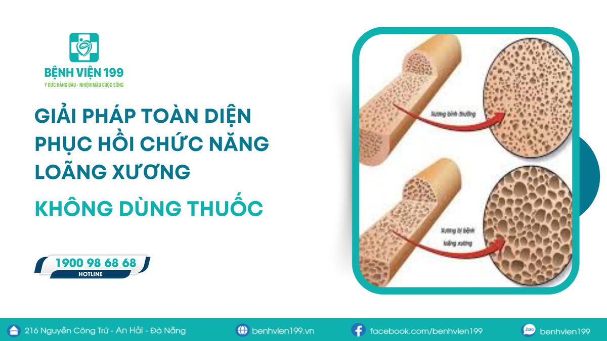 Giải pháp toàn diện phục hồi chức năng loãng xương – Không dùng thuốc