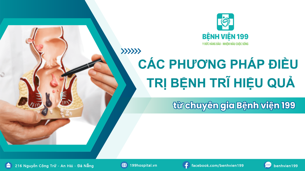 Các phương pháp điều trị bệnh trĩ hiệu quả từ chuyên gia Bệnh viện 199