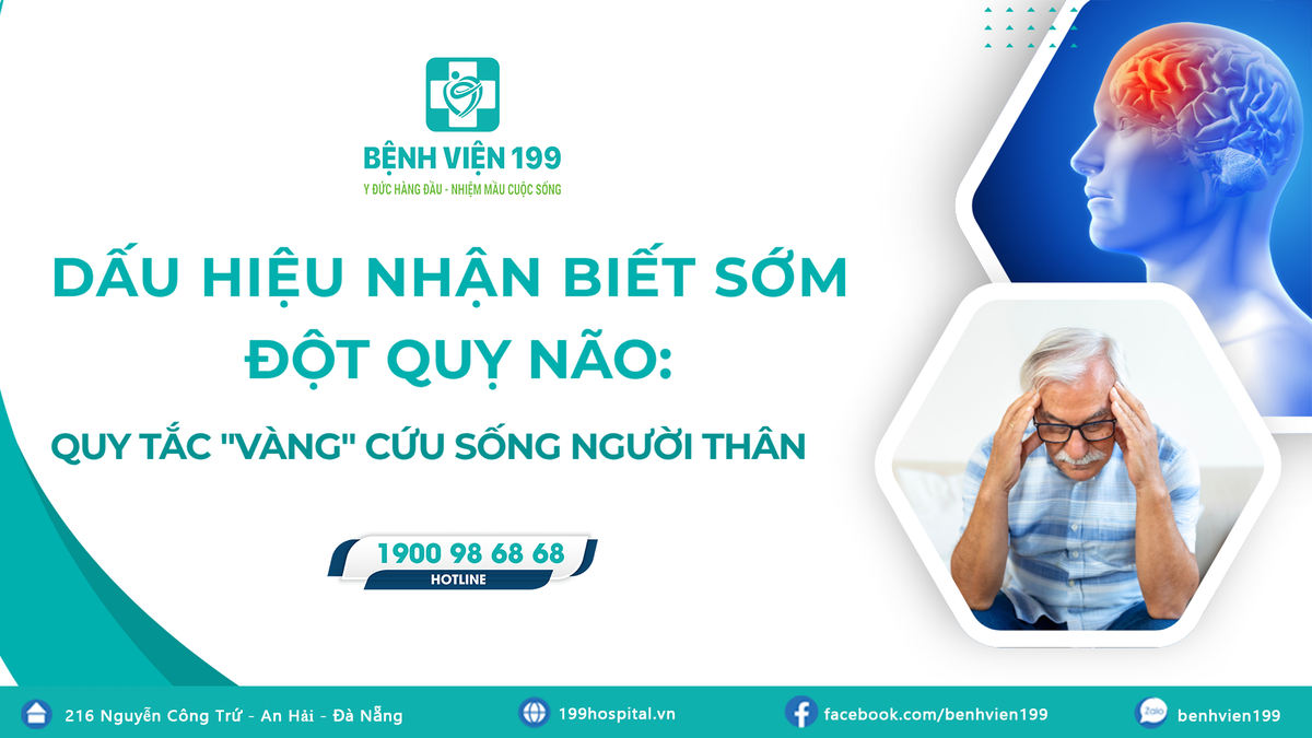 Dấu hiệu nhận biết sớm đột quỵ não: Quy tắc "Vàng" cứu sống người thân