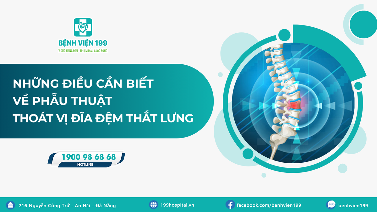 Những điều cần biết về phẫu thuật thoát vị đĩa đệm thắt lưng