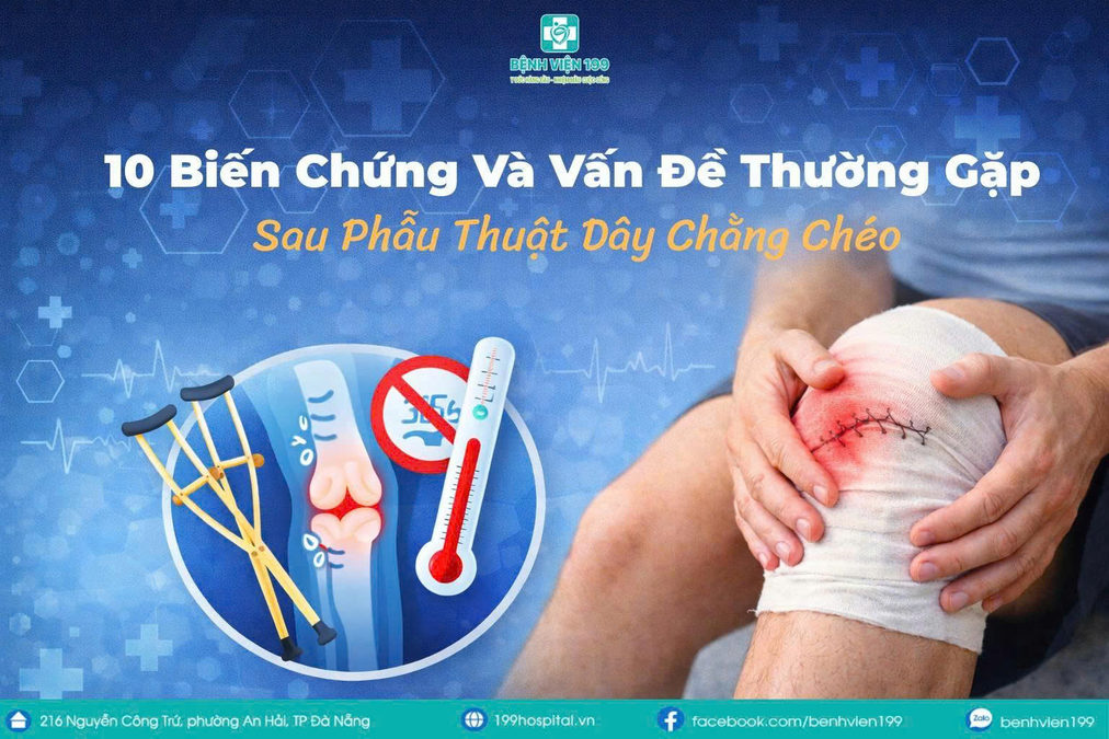 10 Biến Chứng Và Vấn Đề Thường Gặp Sau Phẫu Thuật Dây Chằng Chéo