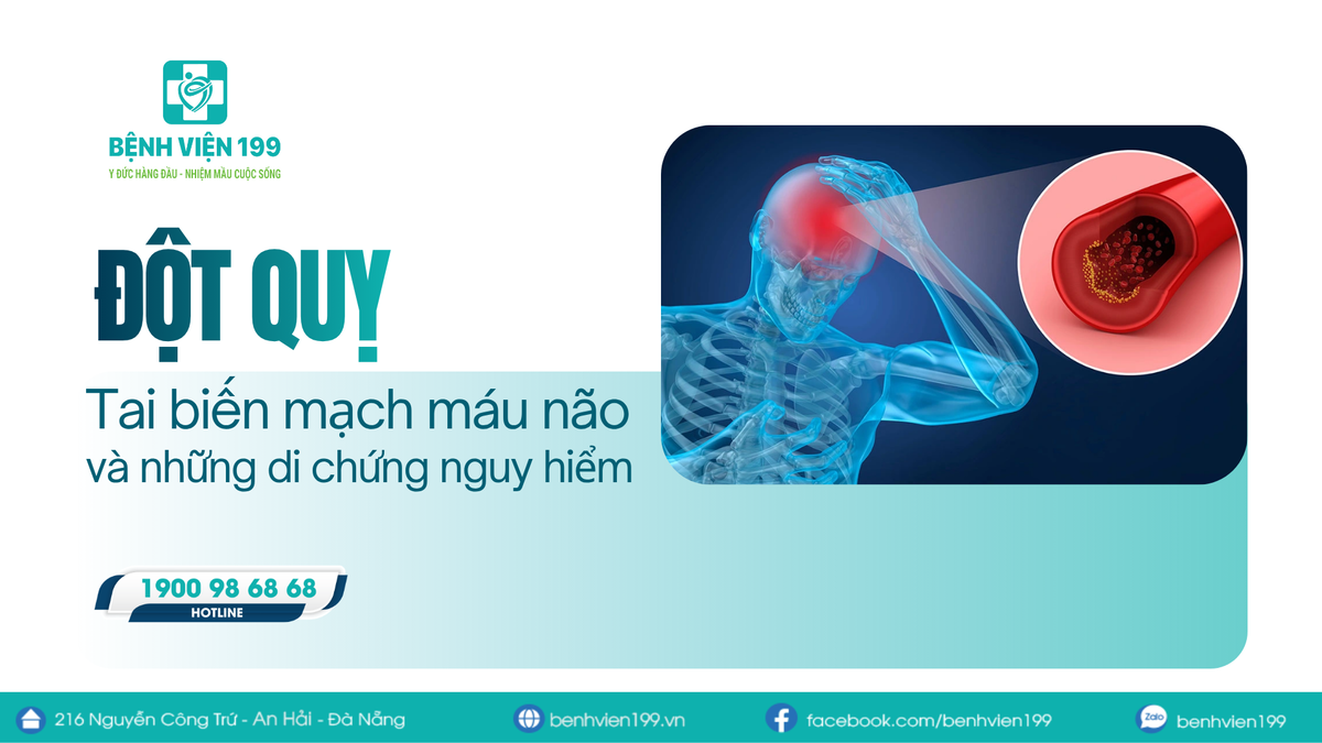 Đột quỵ (Tai biến mạch máu não) và những di chứng nguy hiểm để lại