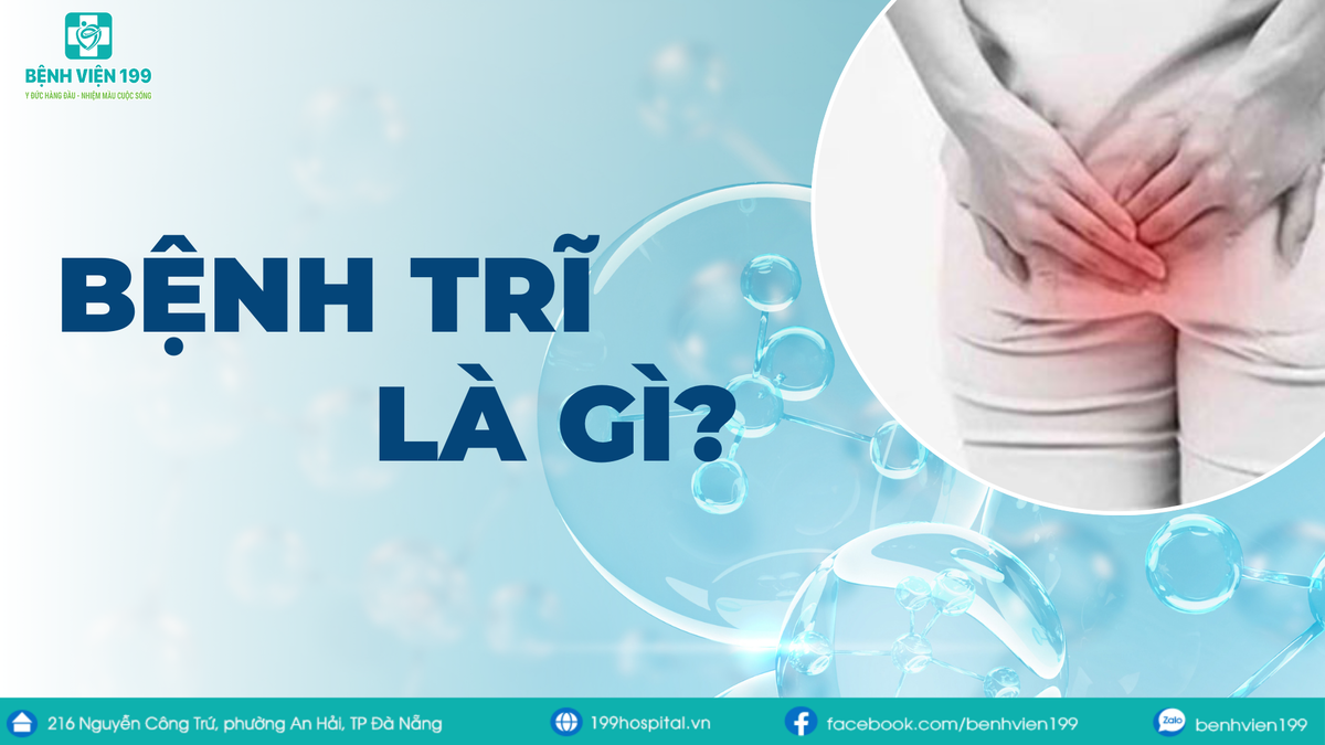 Bệnh Trĩ Là Gì? Dấu Hiệu, Cách Phòng Ngừa Và Điều Trị Hiệu Quả Từ Chuyên Gia