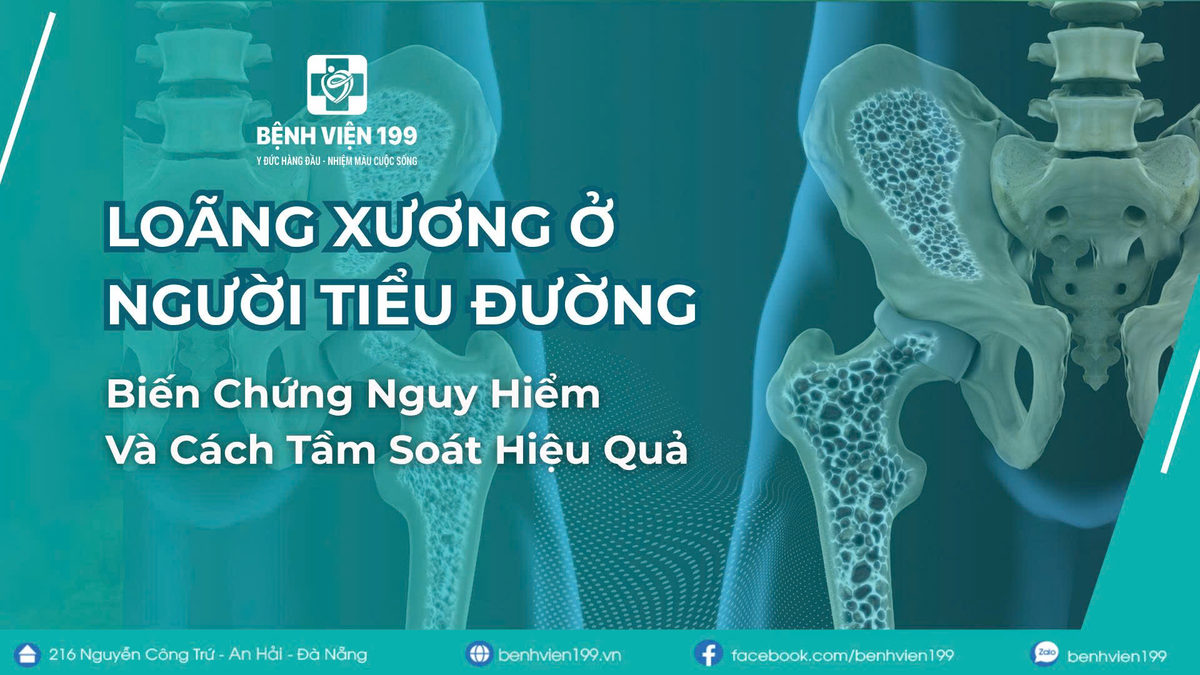 Loãng Xương Ở Người Tiểu Đường: Biến Chứng Nguy Hiểm Và Cách Tầm Soát Hiệu Quả
